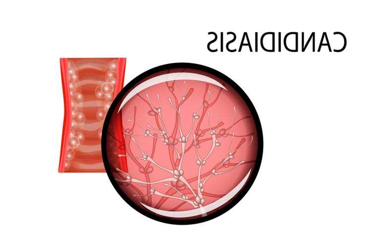 Candida albicans 