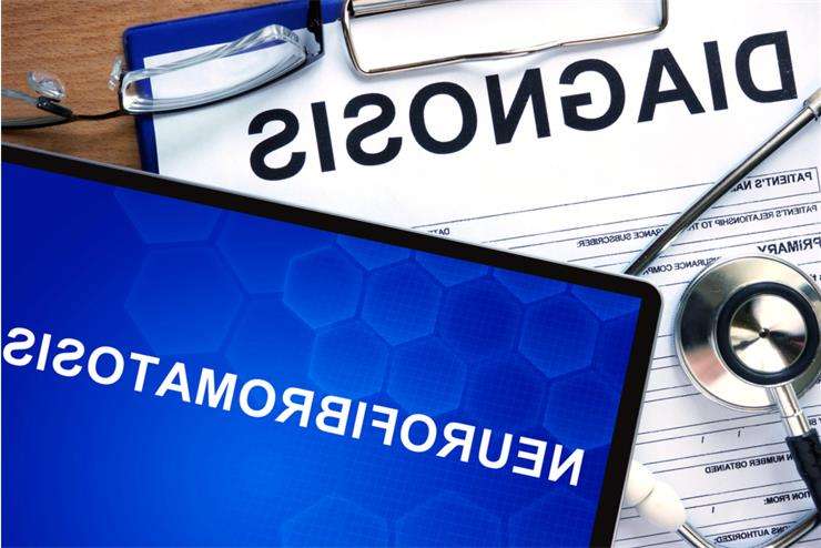 нейрофиброматоз у детей