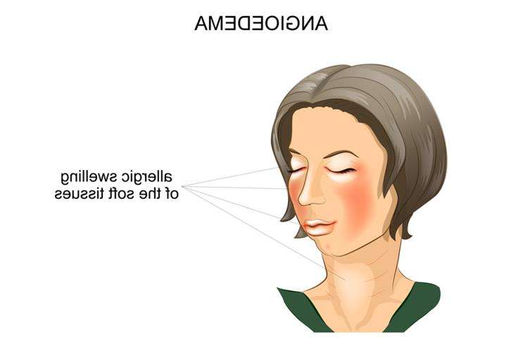 симптомы