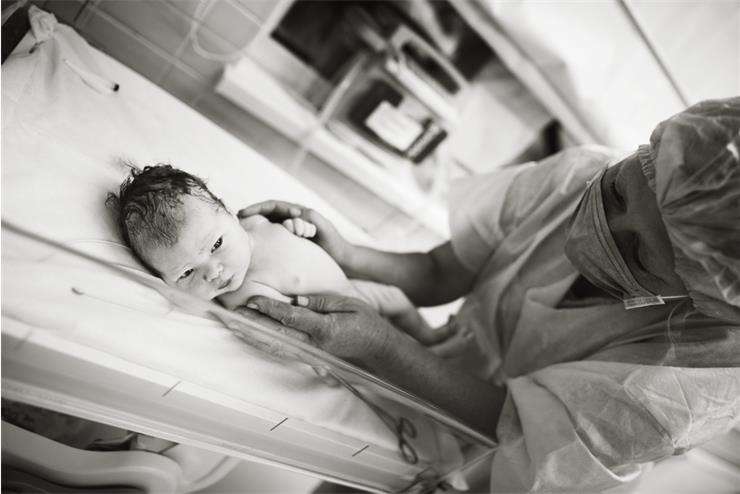 Диагностика водянки у новорожденного