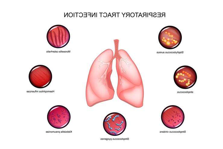 Респираторно-синцитиальная инфекция: симптомы и лечение