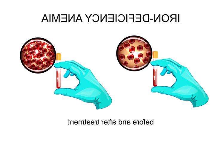 дефицит железа симптомы у женщин