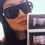 У Німеччині заборонять УЗД вагітним жінкам