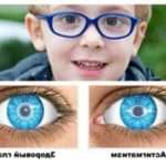 Астигматизм у дітей: як визначити і вилікувати