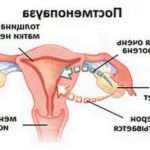 Причини появи серозометры в постменопаузі і методи лікування