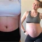 Реальні історії: як зменшити або запобігти появі розтяжок на шкірі