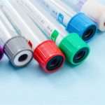 Аналіз на вовчаковий антикоагулянт при вагітності – що це і навіщо