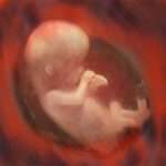 Ознаки і причини завмерлої вагітності