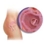 Причини і симптоми анэмбрионии