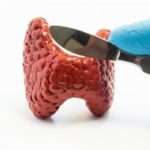 Наслідки операції по видаленню щитовидної залози у жінок