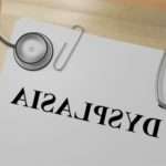 Симптоми і лікування дисплазії шийки матки в залежності від ступеня онкології