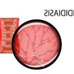 Ураження грибком Кандида альбіканс у жінок: симптоми і лікування