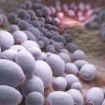 Що робити, якщо виявлені дріжджові гриби в калі у дитини