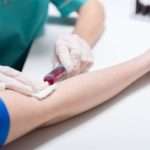 АЧТЧ: норма у жінок в крові і розшифровка аналізів