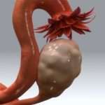 Що таке штучний клімакс і для чого він потрібен