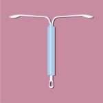 Чи можна завагітніти зі спіраллю?