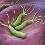 Ознаки розвитку та методи лікування виразки шлунку у дітей