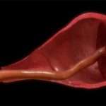 Чим загрожує передчасне старіння плаценти при вагітності