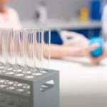 Причини підвищення і пониження норми лужної фосфатази у жінок