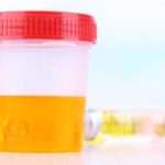 Поява кетонових тіл у сечі при вагітності