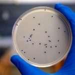 Симптоми та методи лікування стафілокока в мазку у жінок