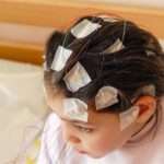 Чи можна вилікувати епілепсію у дітей