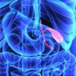 Чим небезпечні поліпи в жовчному міхурі: лікування народними засобами, операція