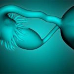 Симптоми застуженных придатків у жінок