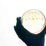 Симптоми і причини дисбактеріозу піхви