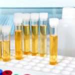 Фосфати в сечі при вагітності: причини та корекція