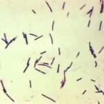 Чим небезпечні клостридії в калі у дитини