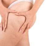 Переваги і недоліки антицелюлітної дієти