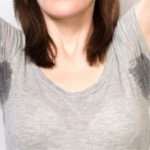 Причини підвищеної пітливості тіла у жінок і методи лікування