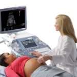 Допплерографія при вагітності