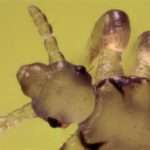 Як лікувати педикульоз у дітей, причини і симптоми захворювання