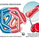 Причини порушення норми гемоглобіну у вагітних, профілактика відхилень