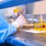 Чому зявляється кров у сечі у жінок