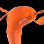 Причини мізерних місячних фізіологічного і патологічного характеру