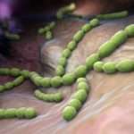 Особливості перебігу та лікування стрептококових інфекцій у дітей