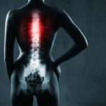 Хвороба Бехтерева у жінок: причини, симптоми, діагностичні заходи, лікування та прогноз