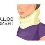 Для чого потрібен комір Шанца новонародженому