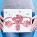 Лікування загину шийки матки і шанс завагітніти