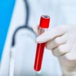 Норма wbc в аналізі крові у жінок