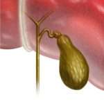 Деформація жовчного міхура у дитини: ознаки і терапія