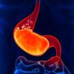 Якою має бути дієта при печії