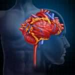 Ознаки інсульту у жінок