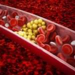 Причини підвищення тригліцеридів у крові жінок