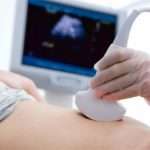 УЗД на ранніх термінах вагітності: показання, підготовка, терміни