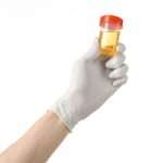 Підвищений білок у сечі при вагітності: як виявити причини і запобігти наслідки