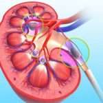 Симптоми і лікування каменів в нирках при вагітності